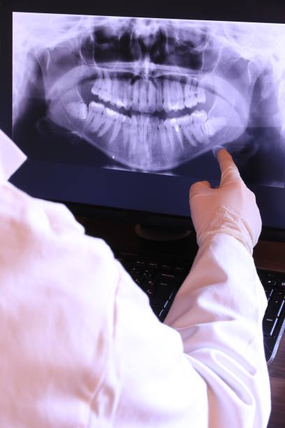 Best Emergency Dentist for Knocked-Out Tooth in East Islip, NY