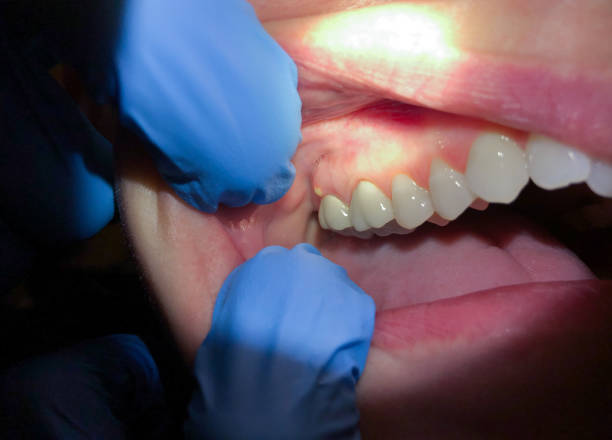 Best Mobile Emergency Dentist in East Islip, NY